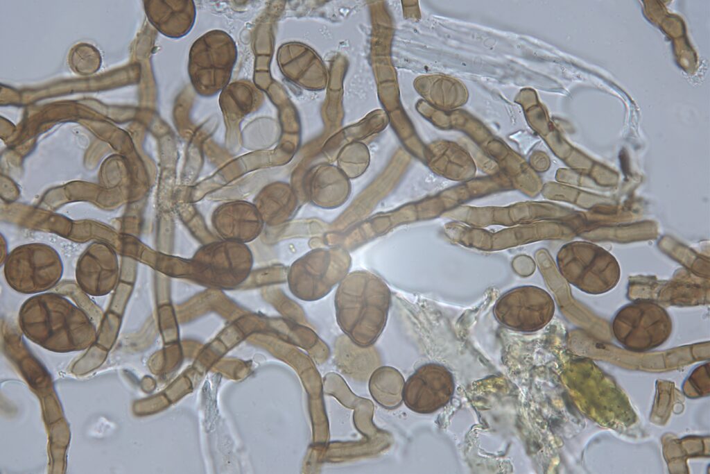 Mould Testing-Ulocladium